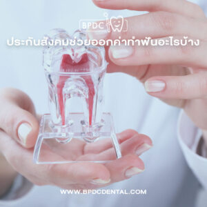 ทำฟันประกันสังคม